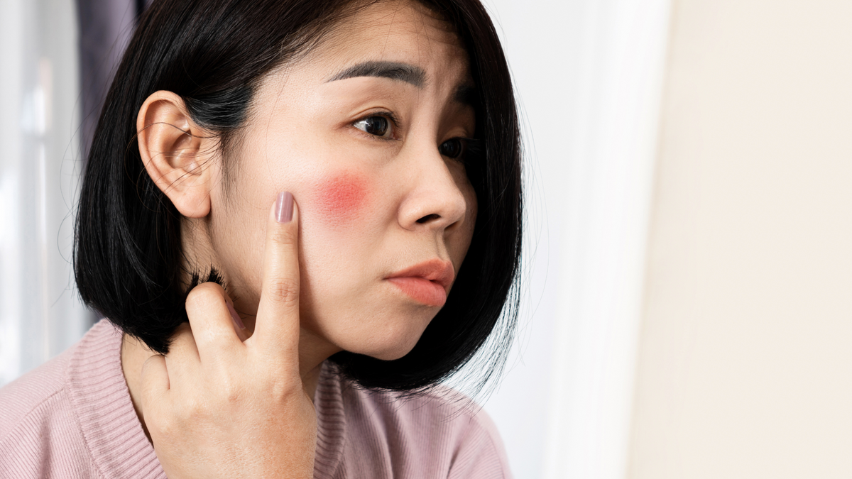 Different Face Rashes Skin redness: causes, types and treatments – Reborn Paris
