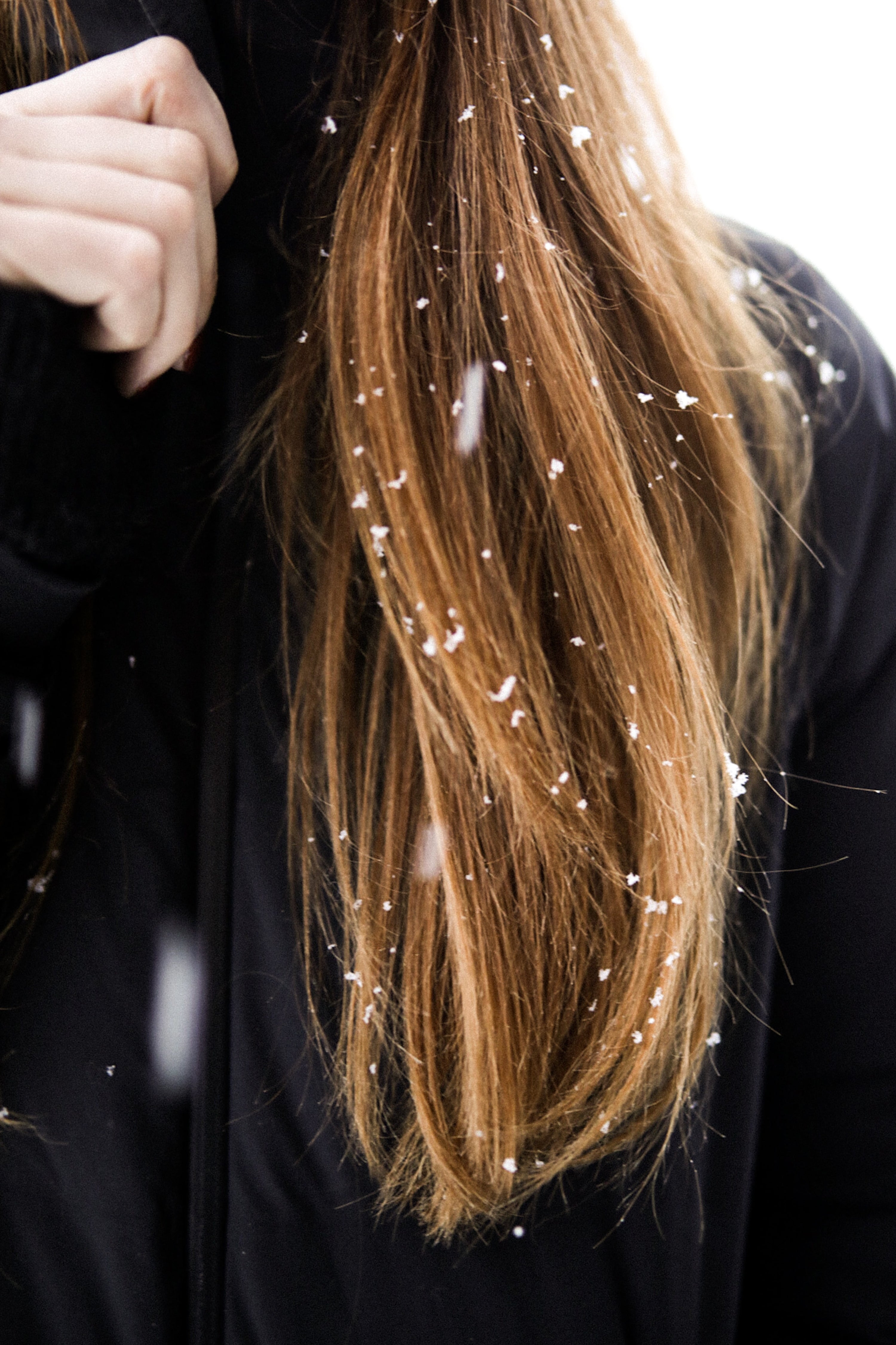Perte de cheveux à cause du froid de l'hiver. La neige dans les cheveux, symbolique de l'agression potentielle de notre cuir chevelu en saison froide. 